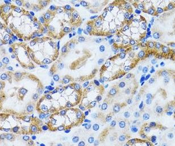 PEX5 Rabbit Polyclonal Antibody