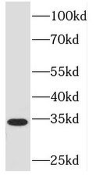 PEX7 Rabbit Polyclonal Antibody