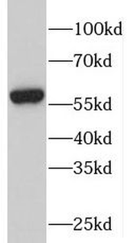 PFKFB2 Rabbit Polyclonal Antibody