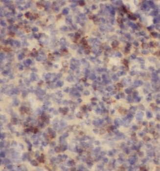 PFKFB2 Rabbit Polyclonal Antibody
