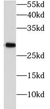 PGAM1 Rabbit Polyclonal Antibody