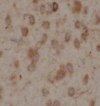 PGAM1 Rabbit Polyclonal Antibody