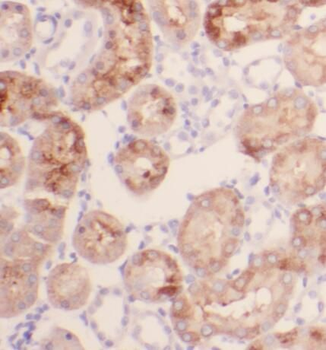 PGBD1 Rabbit Polyclonal Antibody