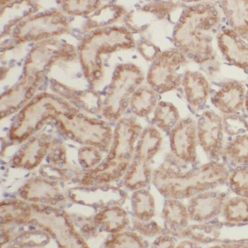 PGBD3 Rabbit Polyclonal Antibody