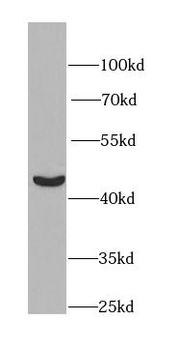 PGK1 Antibody
