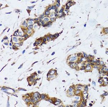 PGRMC1 Rabbit Polyclonal Antibody