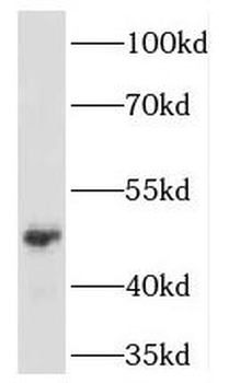 EGLN2 Rabbit Polyclonal Antibody