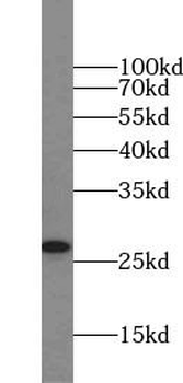 EGLN3 Rabbit Polyclonal Antibody