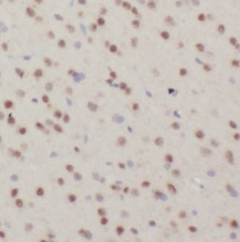 EGLN3 Rabbit Polyclonal Antibody