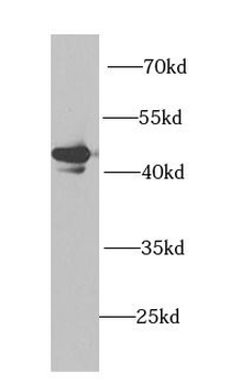 PHKG2 Rabbit Polyclonal Antibody