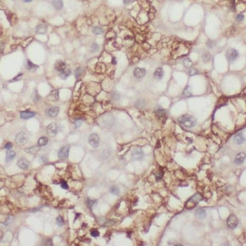 PHKG2 Rabbit Polyclonal Antibody