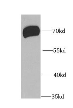 PIAS3 Rabbit Polyclonal Antibody