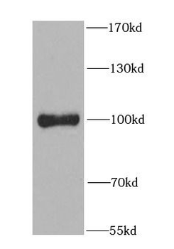 PIBF1 Rabbit Polyclonal Antibody