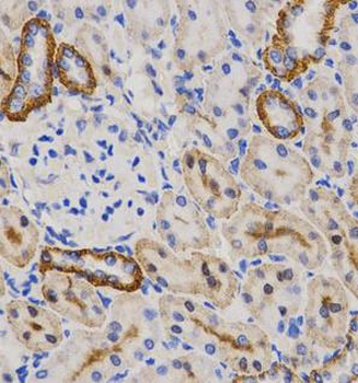PIBF1 Rabbit Polyclonal Antibody