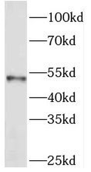 PICK1 Rabbit Polyclonal Antibody