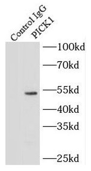 PICK1 Rabbit Polyclonal Antibody
