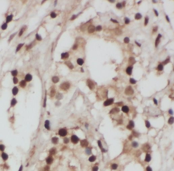 PICK1 Rabbit Polyclonal Antibody