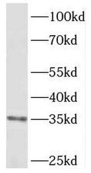 TP53I3 Rabbit Polyclonal Antibody