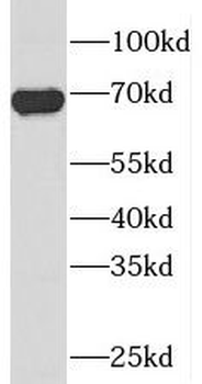 PIGS Rabbit Polyclonal Antibody