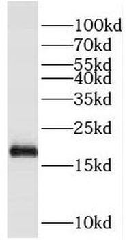 PIK3C2G Rabbit Polyclonal Antibody