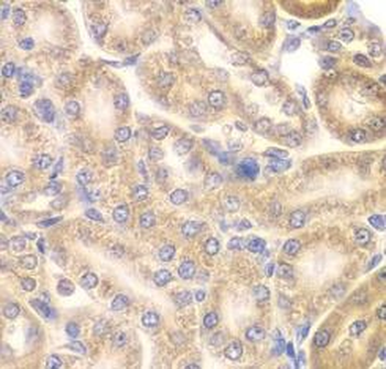 PIP4K2A Rabbit Polyclonal Antibody