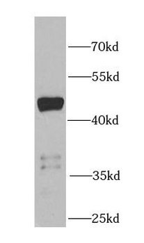 PIP4K2B Rabbit Polyclonal Antibody