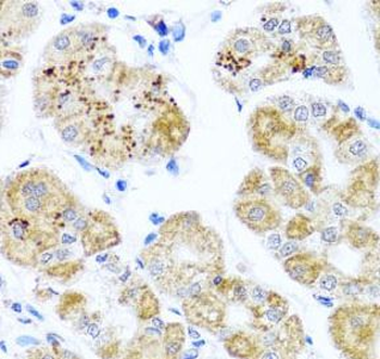 PIP4K2B Rabbit Polyclonal Antibody