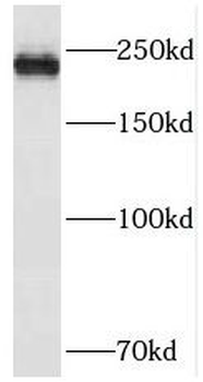 PIKFYVE Antibody