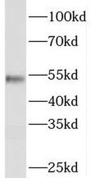 PISD Rabbit Polyclonal Antibody