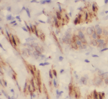 PITPNA Rabbit Polyclonal Antibody