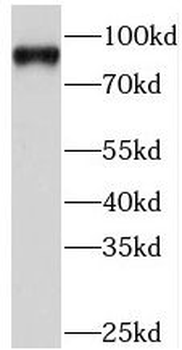 PIWIL1 Rabbit Polyclonal Antibody