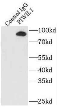 PIWIL1 Rabbit Polyclonal Antibody