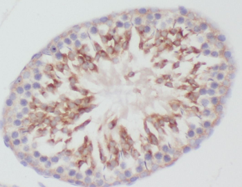 PIWIL1 Rabbit Polyclonal Antibody