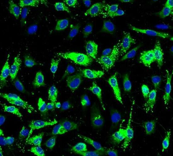 PRKCG Rabbit Polyclonal Antibody