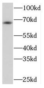 PRKCZ Antibody