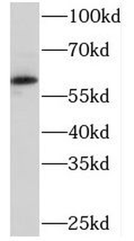 PKLR Rabbit Polyclonal Antibody