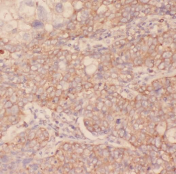 PKLR Rabbit Polyclonal Antibody