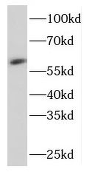 PKLR Rabbit Polyclonal Antibody
