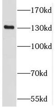 PKN2 Antibody