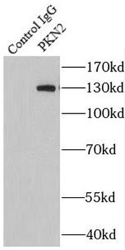 PKN2 Antibody