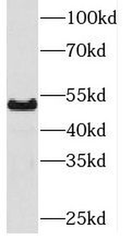 PKNOX1 Rabbit Polyclonal Antibody