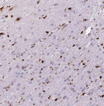 PKNOX1 Rabbit Polyclonal Antibody