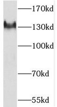 PKP4 Rabbit Polyclonal Antibody