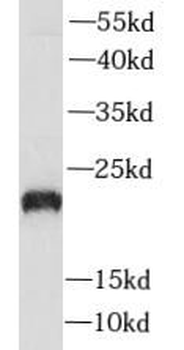 PLA2G12A Rabbit Polyclonal Antibody