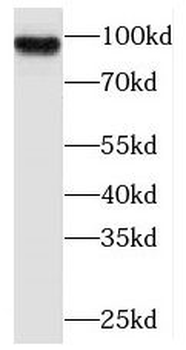 PLA2G4E Rabbit Polyclonal Antibody