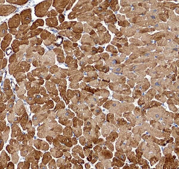 PLA2G4E Rabbit Polyclonal Antibody