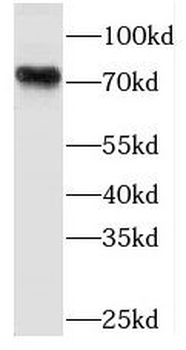 PLAA Rabbit Polyclonal Antibody