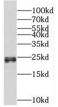 CSH1 Antibody