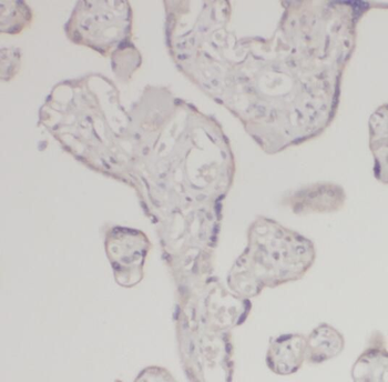 CSH1 Antibody