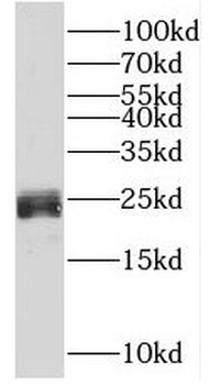 CSH1 Antibody